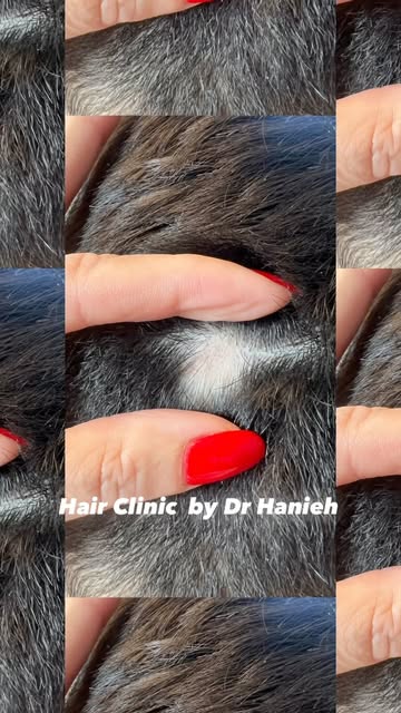 “The sooner you start treating hair loss, the faster you see results — and the sooner you regain you