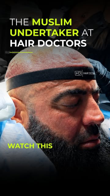 Throwing it back to the day we treated Ahmad’s crown area at Hair Doctors. It was a privilege to be 
