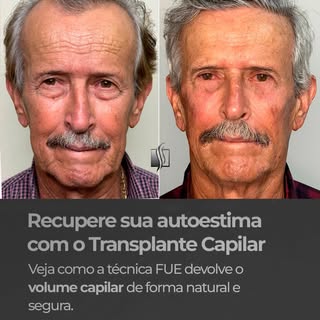 Você sabia que é possível recuperar a autoestima com um procedimento seguro e natural? 

A técnica F