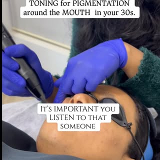 Someone in their 30s will tell you this — listen carefully.

Perioral pigmentation doesn’t fade with