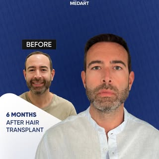 At Medart Hair, we take pride in restoring confidence one strand at a time! 
 Check out this amazing