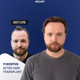 At Medart Hair, we take pride in restoring confidence one strand at a time! 
 Check out this amazing