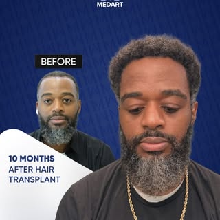 At Medart Hair, we take pride in restoring confidence one strand at a time! 
 Check out this amazing