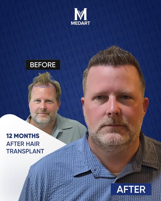 At Medart Hair, we take pride in restoring confidence one strand at a time! 
 Check out this amazing