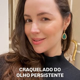 Você trata o craquelado dos olhos, mas ele continua aparecendo?👇🏻

Creme, skincare, maquiagem…

Vo