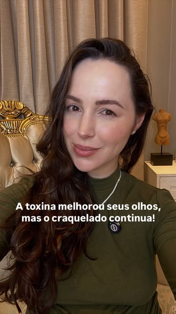 A toxina pode melhorar o movimento, mas algumas linhas continuam aparecendo.👇🏻

Você faz toxina bo