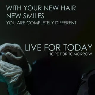 You can contact us for hair transplatation and any questions related to hair.

#hair #hairtransforma
