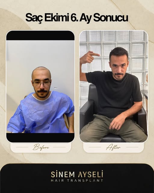 📌 Uyarı: Paylaşımlarımız bilgilendirme niteliğindedir.
✅ Tüm cerrahi ve estetik işlemlerde sonuçlar