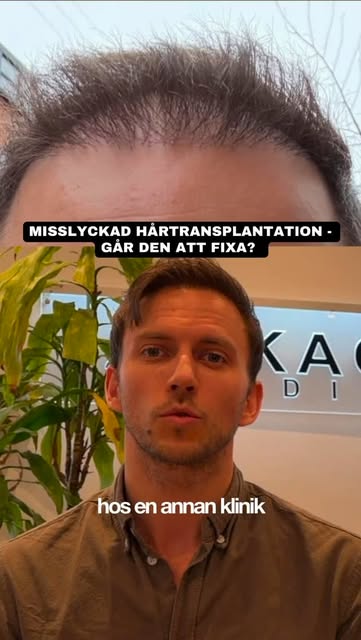 3 fel under en och samma operation… Kan vi rätta till någon annans misstag? Se hela videon på YouTub