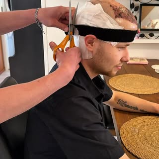 Toinen päivä leikkauksesta!

*Hiustensiirrosta saatu alennus @akacia_medical 

#hairtransplantation 