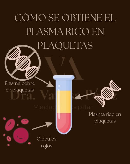 ¿Cómo se obtiene el plasma rico en plaquetas?