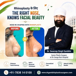 👃✨ The right nose can beautifully complement your facial features.
Rhinoplasty is not simply about 