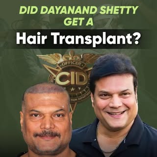 From the iconic show CID, even Dayanand Shetty chose QHT Clinic for his hair transplant — highlighti
