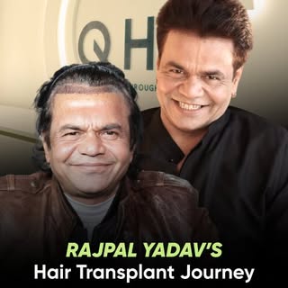 Bollywood Actor Rajpal Yadav, chose QHT Clinic for his hair transplant — highlighting the importance