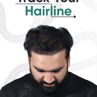 Trace your dream hairline. Then let us build it for real. 💚

This interactive one's fun — but the a
