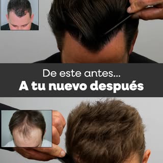 ✨ La diferencia está en los resultados ✨
Con nuestro método logramos transformaciones visibles y nat