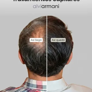 😍👀 Los resultados hablan por sí solos.

De un cabello debilitado a una imagen renovada gracias a n