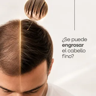 Un cabello más fino no siempre significa pérdida irreversible. 💇‍♂️😊

🙌 Con el tratamiento indica