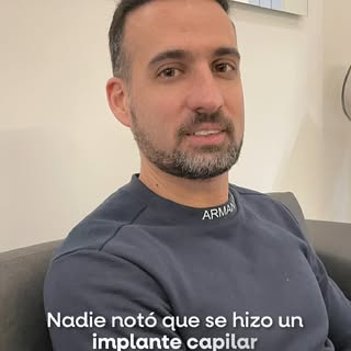 ✨ El mejor implante capilar es el que se ve natural. 💇‍♂️ Nadie nota el procedimiento, solo que te 