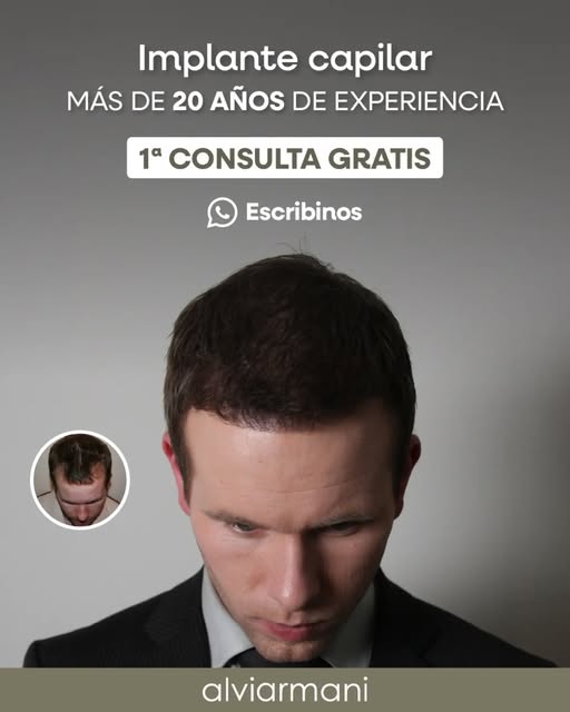 ¿Estás pensando en recuperar tu pelo? 💇‍♂️🤔

✅ En Alvi Armani contamos con más de 20 años de exper
