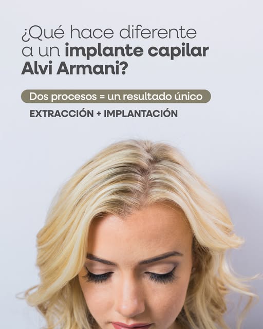 😊 Un implante capilar tiene dos etapas clave, y no son lo mismo.

👀No alcanza con una buena extrac