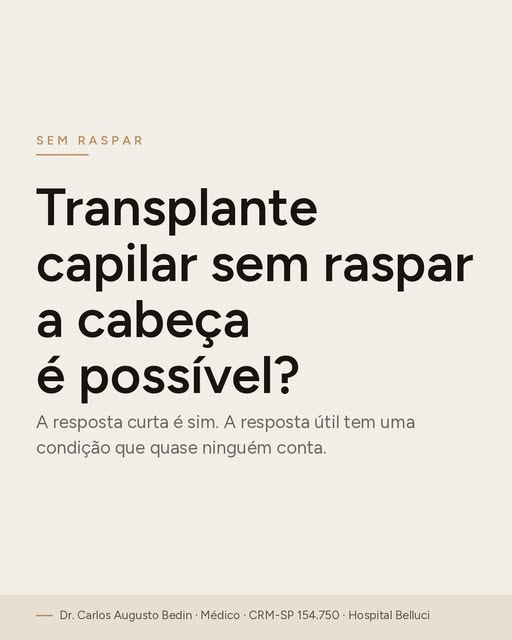 "Dá para fazer transplante capilar sem raspar a cabeça?"

Dá. A técnica existe, é feita, e para uma 