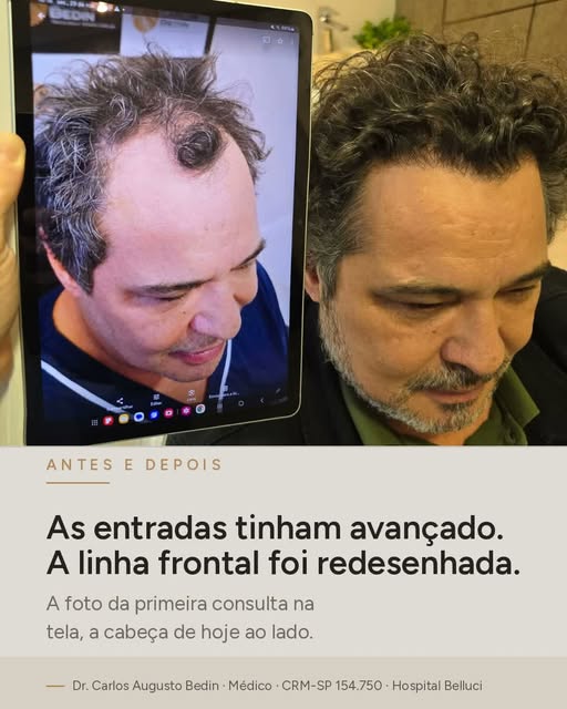 As entradas tinham avançado. A linha frontal foi redesenhada.

Na imagem, a foto da primeira consult
