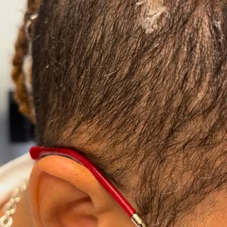 Tools of the Trade — Hands-On Training Makes the Difference

Success in trichology goes beyond theor