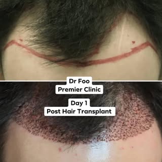 “Your Hair is 90% of Your Selfie”
Don’t you agree? 
Hair loss affects 35 million men & 21 million  w