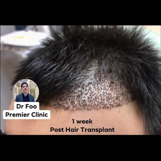 “Your Hair is 90% of Your Selfie”
Don’t you agree? 
Hair loss affects 35 million men & 21 million  w