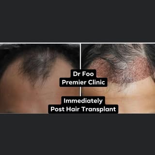 “Your Hair is 90% of Your Selfie”
Don’t you agree? 
Hair loss affects 35 million men & 21 million  w