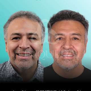 From Patient to a strong brand ambassador! 

Tony Torres, a healthcare professional from Utah, found