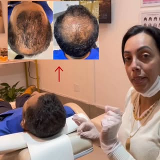 Ele não fez transplante.
Ele tratou a raiz do problema.

Esse é um dos casos mais impressionantes da