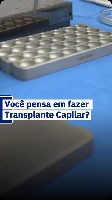 Você pensa em fazer um transplante capilar, mas continua adiando?

Muitas vezes, o primeiro passo é 