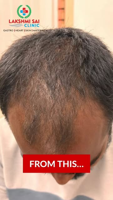 ✨ Healthy Hair. Visible Transformation. ✨

Another successful hair transformation at Lakshmi Sai Cli