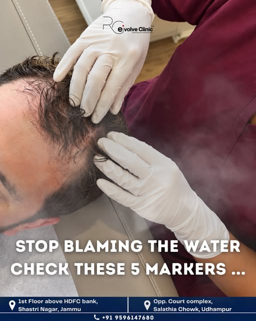 Stop blaming the water for your hair loss! 🚫

Before switching another shampoo, evaluate your inter