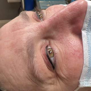 Procedure Eyeliner 🫶🏻✨ 

Book Now Your Free Evaluation:
☎ (508) 577-7697
💻newreflectionspmu.com
�