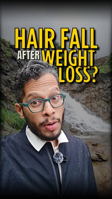 Hair shedding after rapid weight loss can happen because the body goes through stress and nutritiona