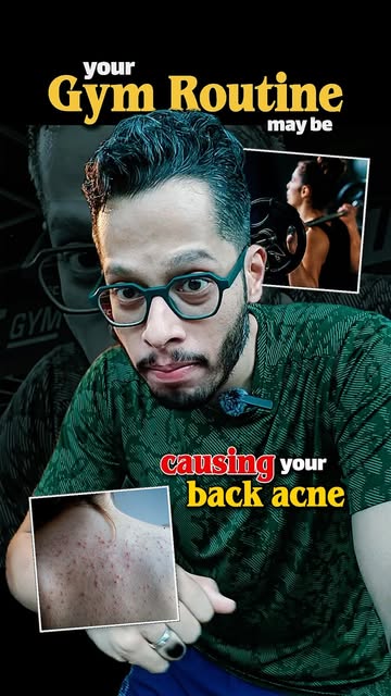Back acne after workouts is common, especially when sweat, tight clothes, friction, and delayed show