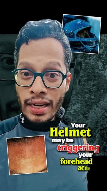 Forehead bumps after riding may not always be because of skincare.

Sweat, friction, dirty helmet pa