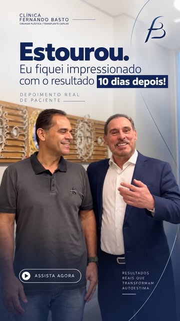 Menos de 3 meses de transplante capilar e os primeiros resultados já começam a aparecer. 

O Fernand