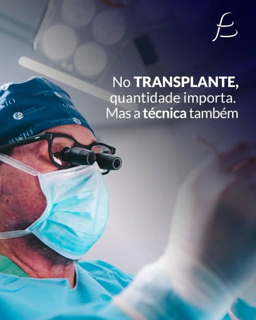 Imagine ter uma área doadora perfeitamente compatível com o estágio da calvície mas, na hora da ciru