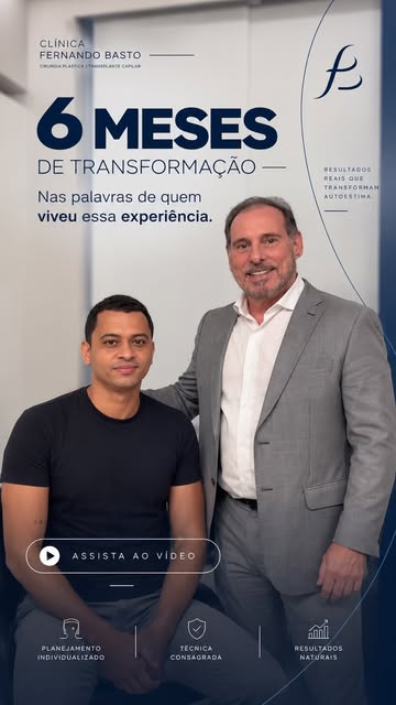 6 meses de transplante capilar e um resultado que fala por si. 

Hoje foi dia de receber o Genésio n