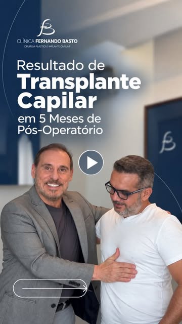 O transplante capilar é uma jornada e cada fase traz uma evolução diferente.

Neste caso, o antes e 