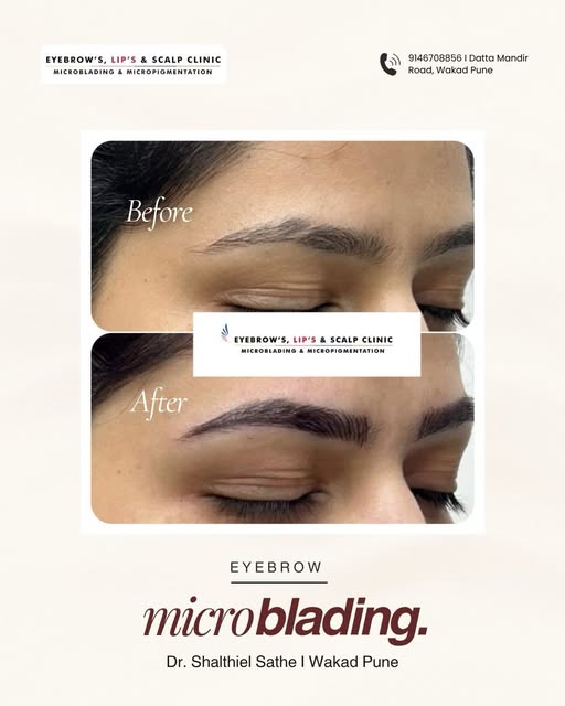 This eyebrow microblading transformation is all about creating natural looking definition while keep