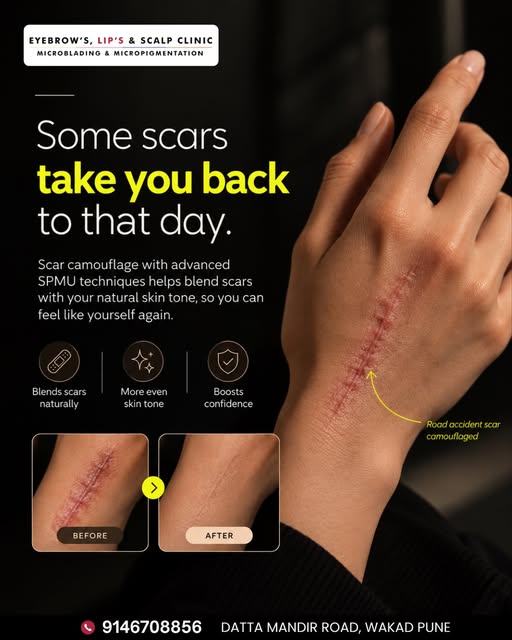 Some scars don’t just stay on the skin. They can bring back memories of the moment that caused them.