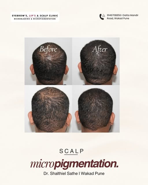 A fuller-looking scalp can change more than just your appearance. It can change how you feel about y