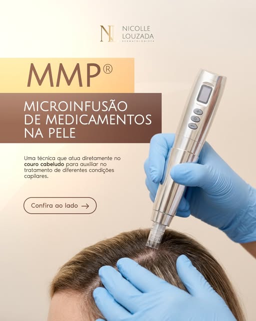 MMP®: Uma técnica que pode auxiliar no tratamento de diferentes condições capilares, indo além da in
