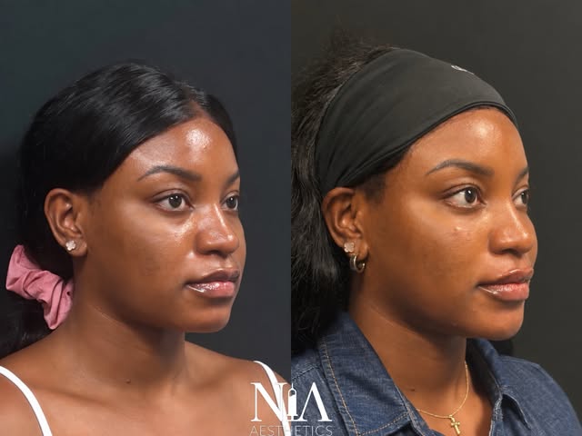 Wedding day prep for this gorgeous bride-to-be 👰🏾‍♀️🤍

THE GOAL: softening shadows, creating a mo