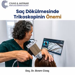🧬Saç Dökülmesinde Trikoskopinin Önemi🧬
Uluslararası, çok merkezli ve geniş bir çalışmada Primer Si